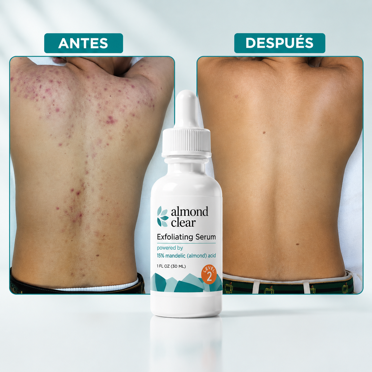 Luzeva™ ClearSkin